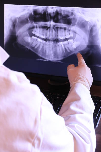 Best Emergency Tooth Extraction in Fort Dick, CA